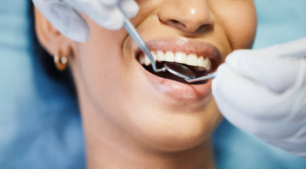 Best Emergency Dental Care for Abscessed Tooth in Schertz, TX