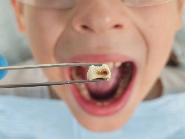 Best Pediatric Emergency Dentist in Schertz, TX
